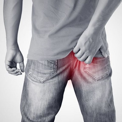 Stop the Discomfort! The Best Ways to Get Rid of Hemorrhoids in riyadh