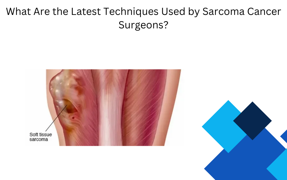 Sarcoma Cancer surgeons in Dubai