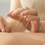 Acupuncture treatment for elderly care