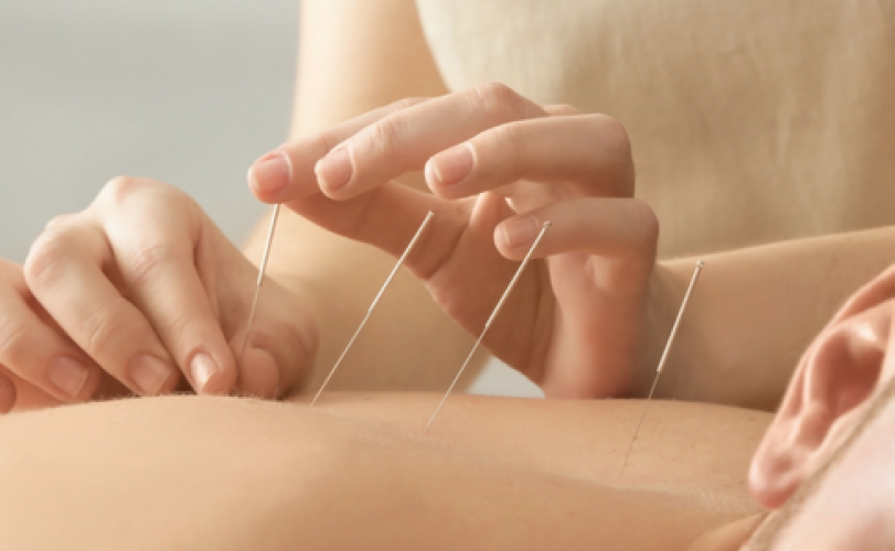 Acupuncture treatment for elderly care