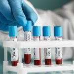 Home Blood Sample Collection