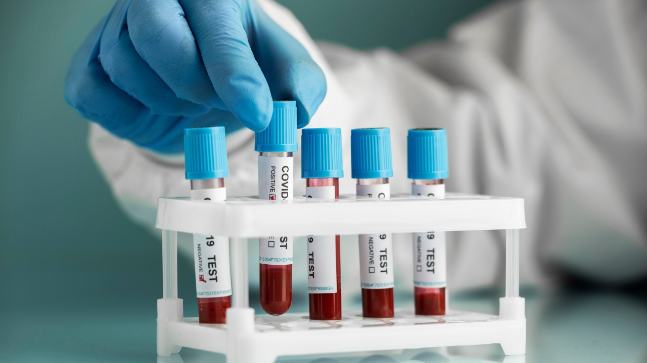 Home Blood Sample Collection