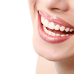 Teeth Whitening for Sensitive Teeth
