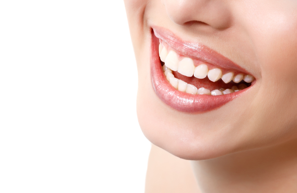 Teeth Whitening for Sensitive Teeth